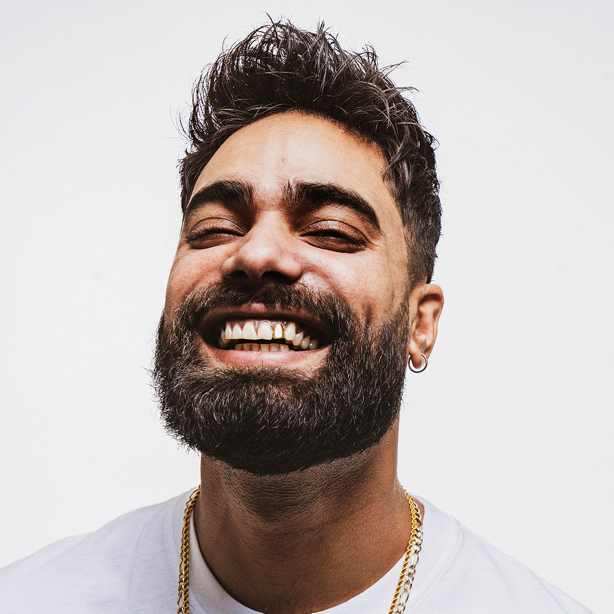 Jeukende baard, dit kun je eraan doen!