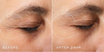 Crystal Retinal Ceramide Eye 6
