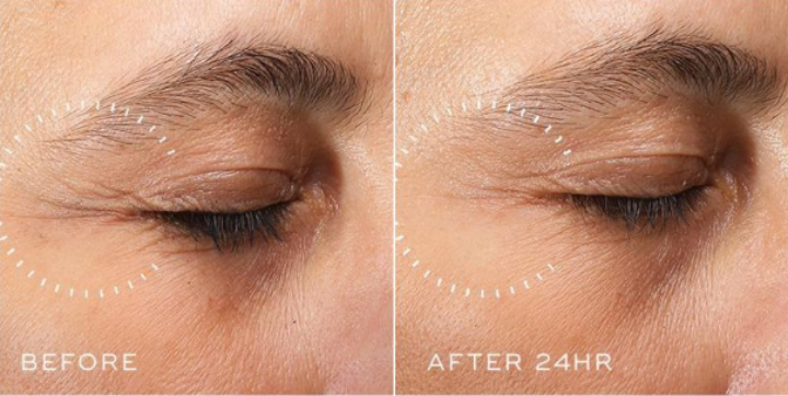 Crystal Retinal Ceramide Eye 6